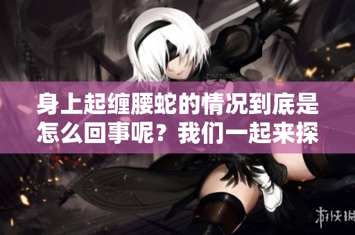 身上起缠腰蛇的情况到底是怎么回事呢？我们一起来探讨一下吧！